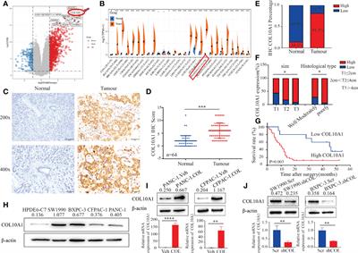 COL10A1-DDR2 axis promotes the progression of pancreatic cancer by regulating MEK/ERK signal transduction